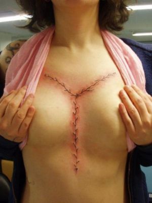 autopsy scar.jpg